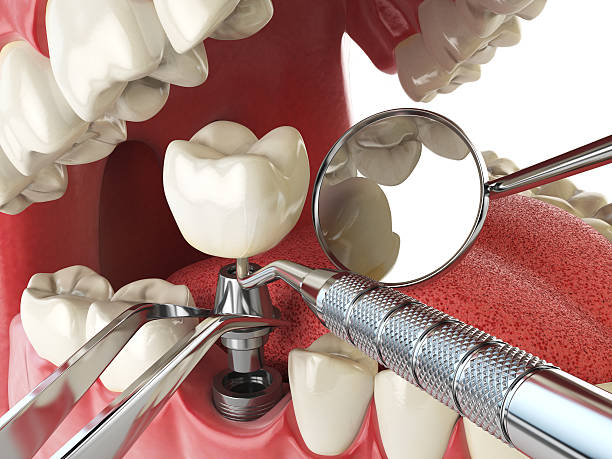 Best Walk-In Emergency Dentist in Watseka, IL